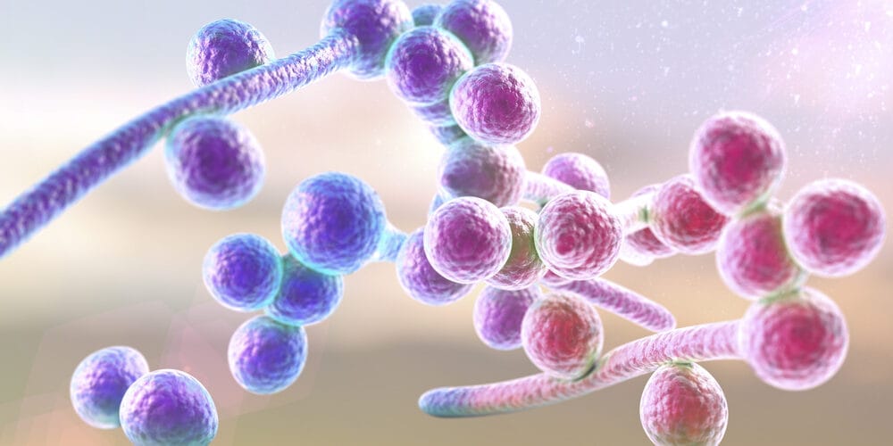 Smear of candida in medical setting